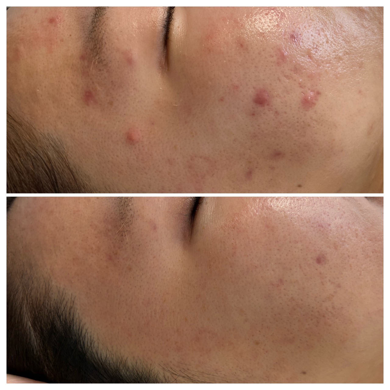 20代女性
